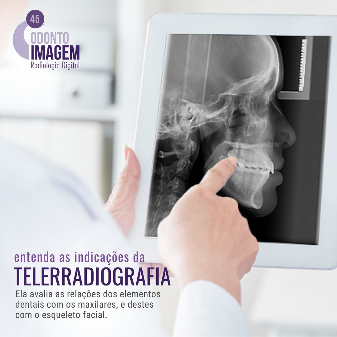 entenda-as-indicacoes-de-teleradiografias