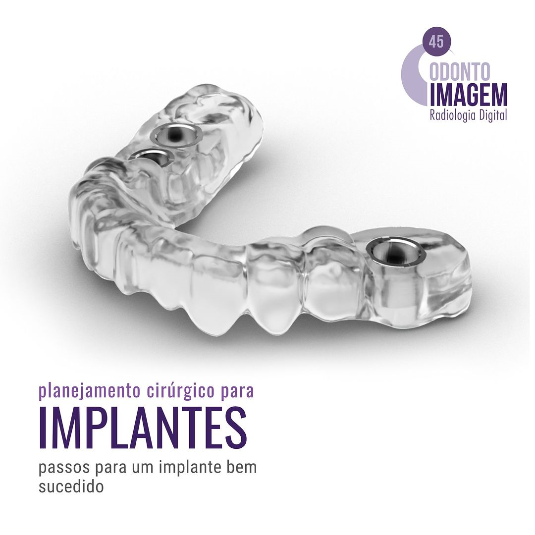 planejamento-cirurgico-para-implantes