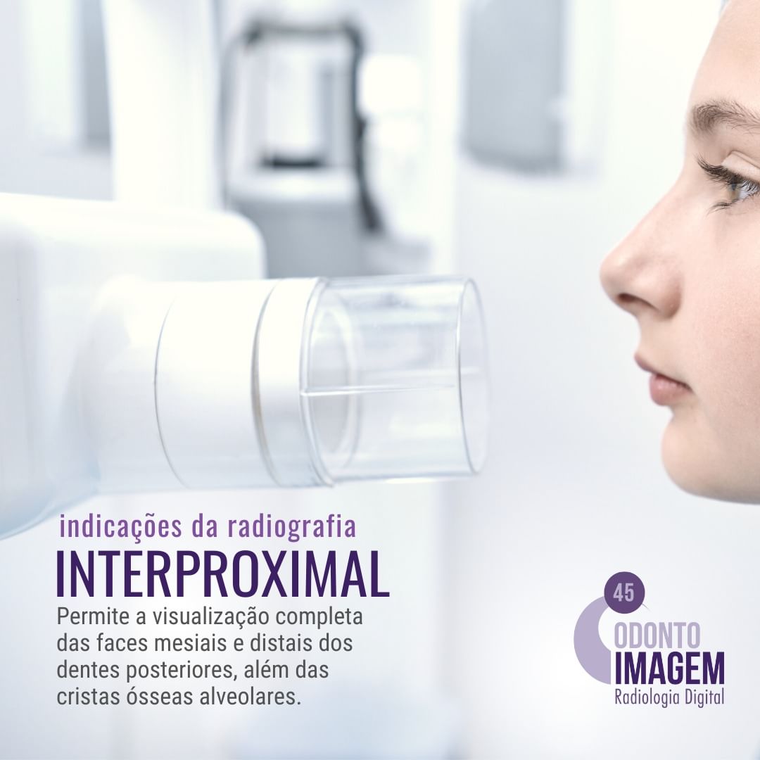 indicacoes-da-radiologia-interproximal