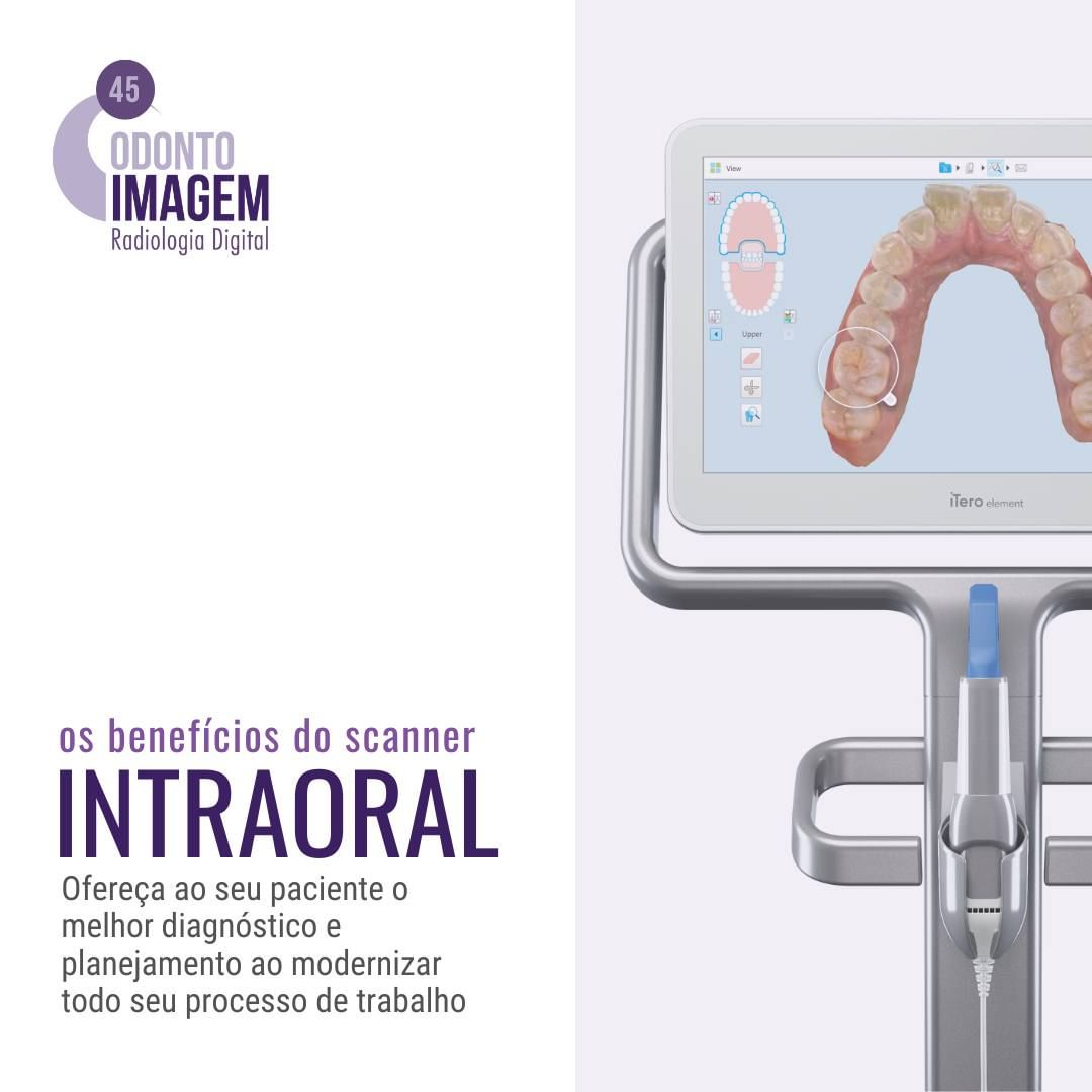 os-beneficios-do-scanner-intraoral