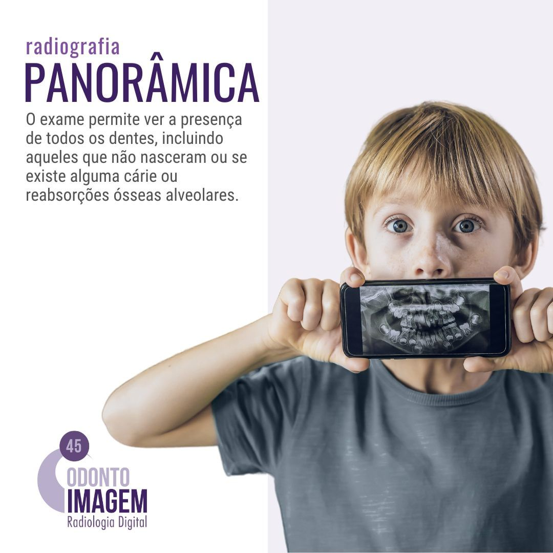 radiografia-panoramica