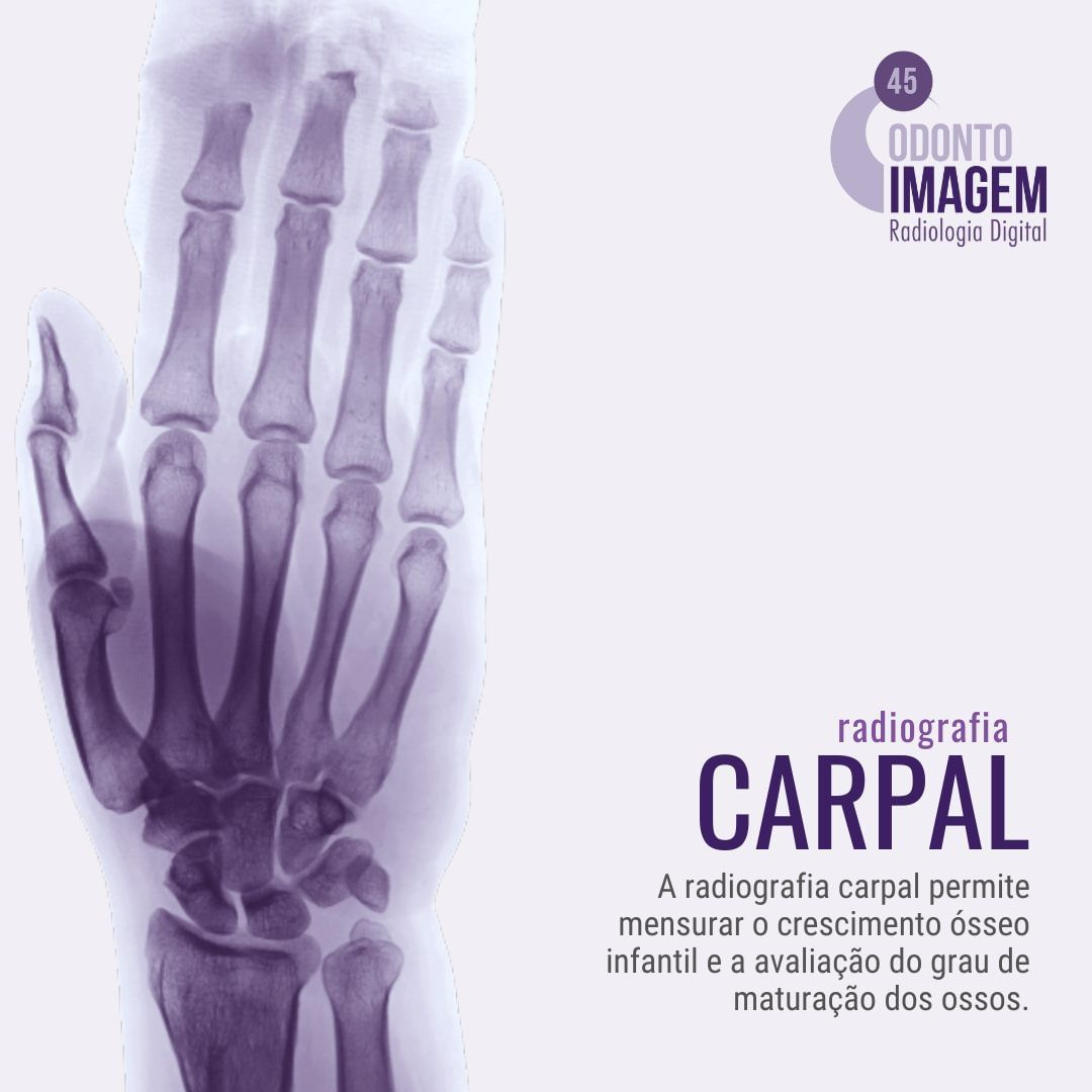 radiografia-carpal