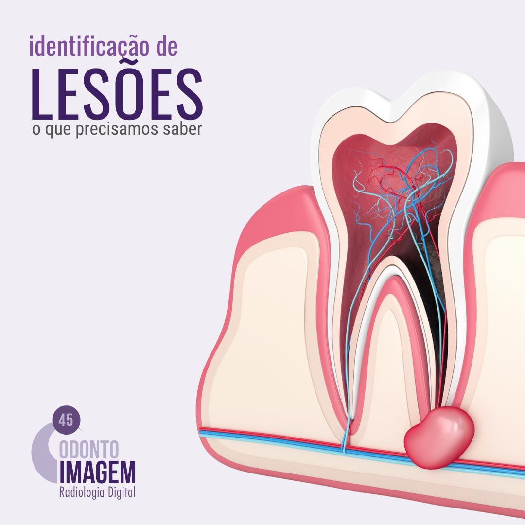 identificacao-de-lesoes