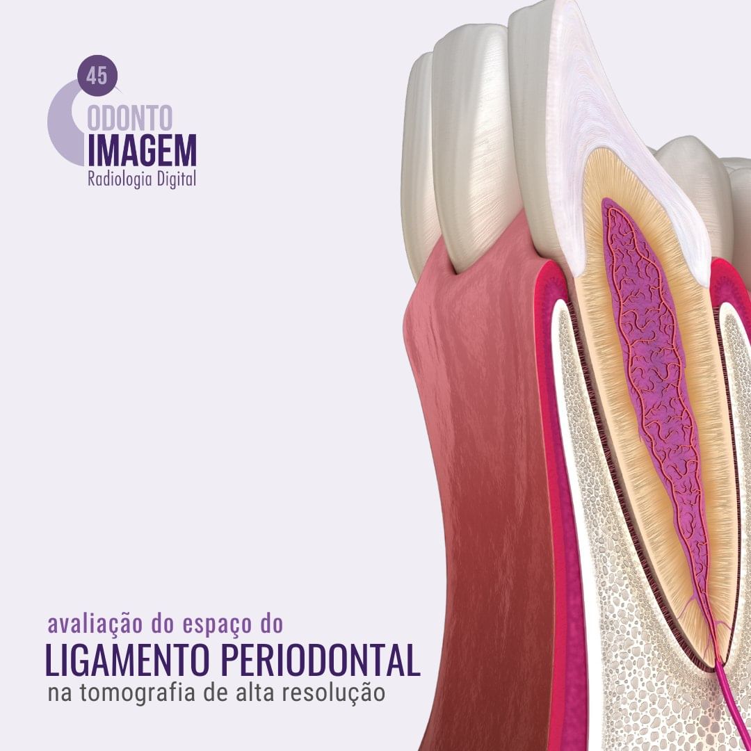 avaliacao-do-espaco-do-ligamento-periodontal