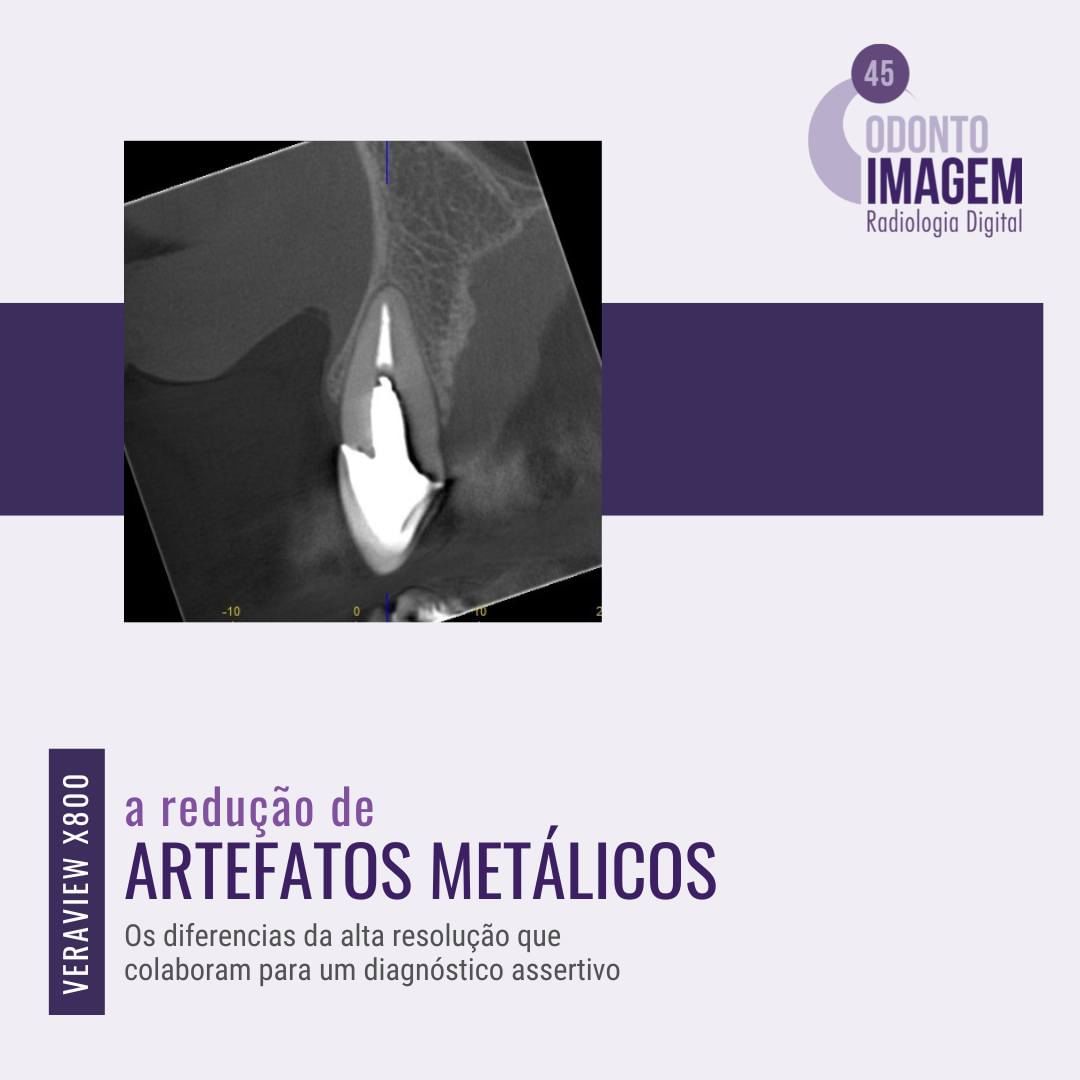 a-reducao-de-artefatos-metalicos