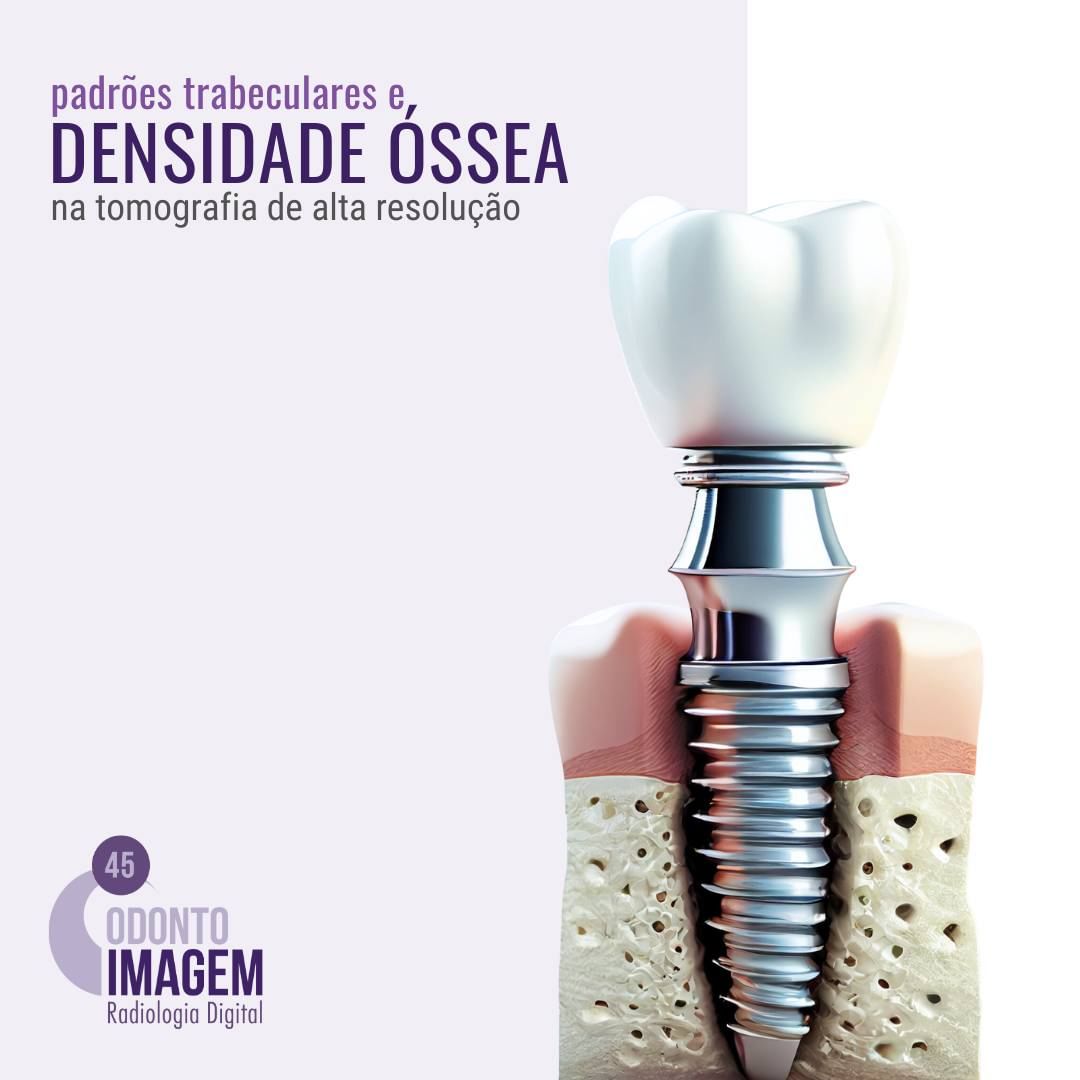 padroes-trabeculares-e-densidade-ossea