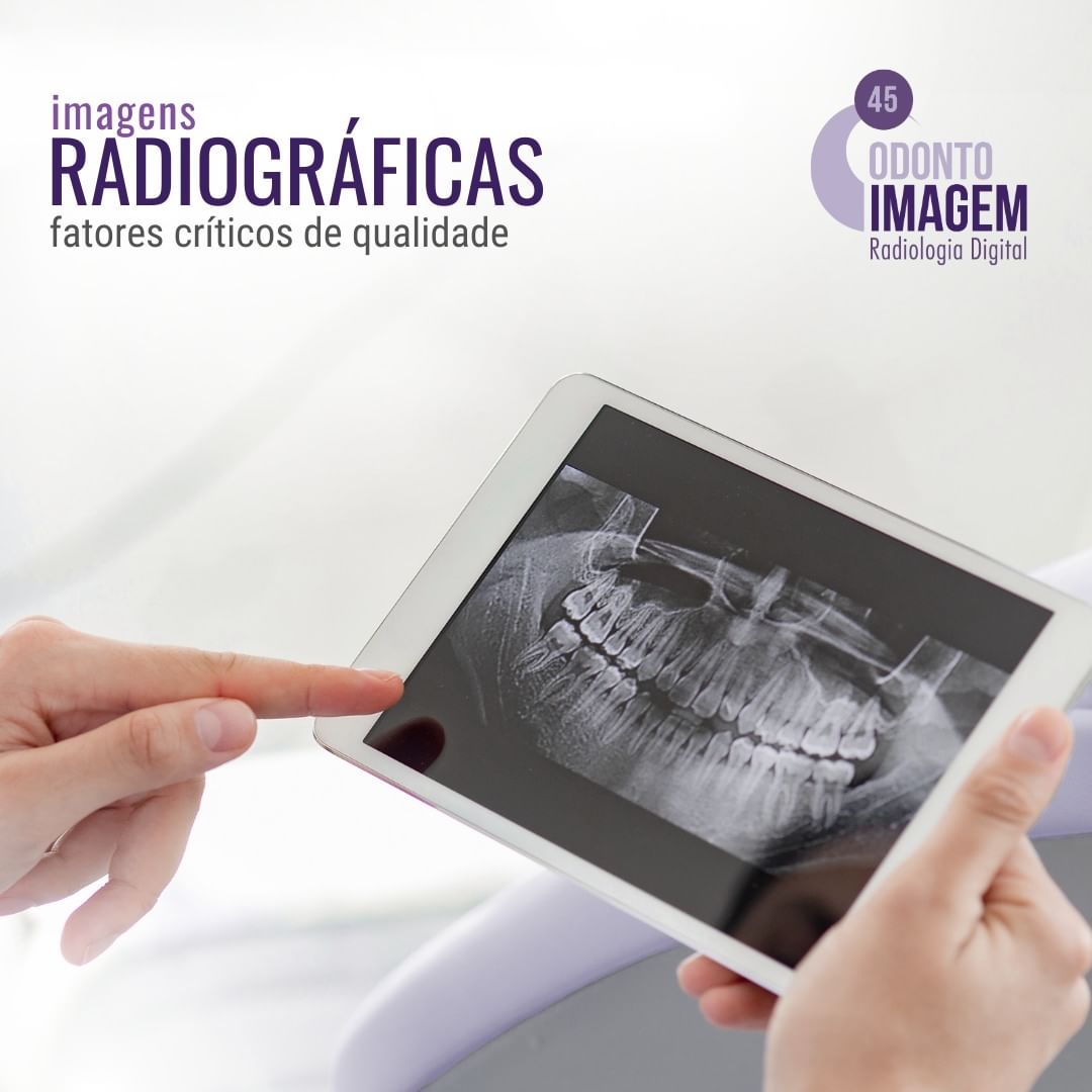 imagens-radiograficas