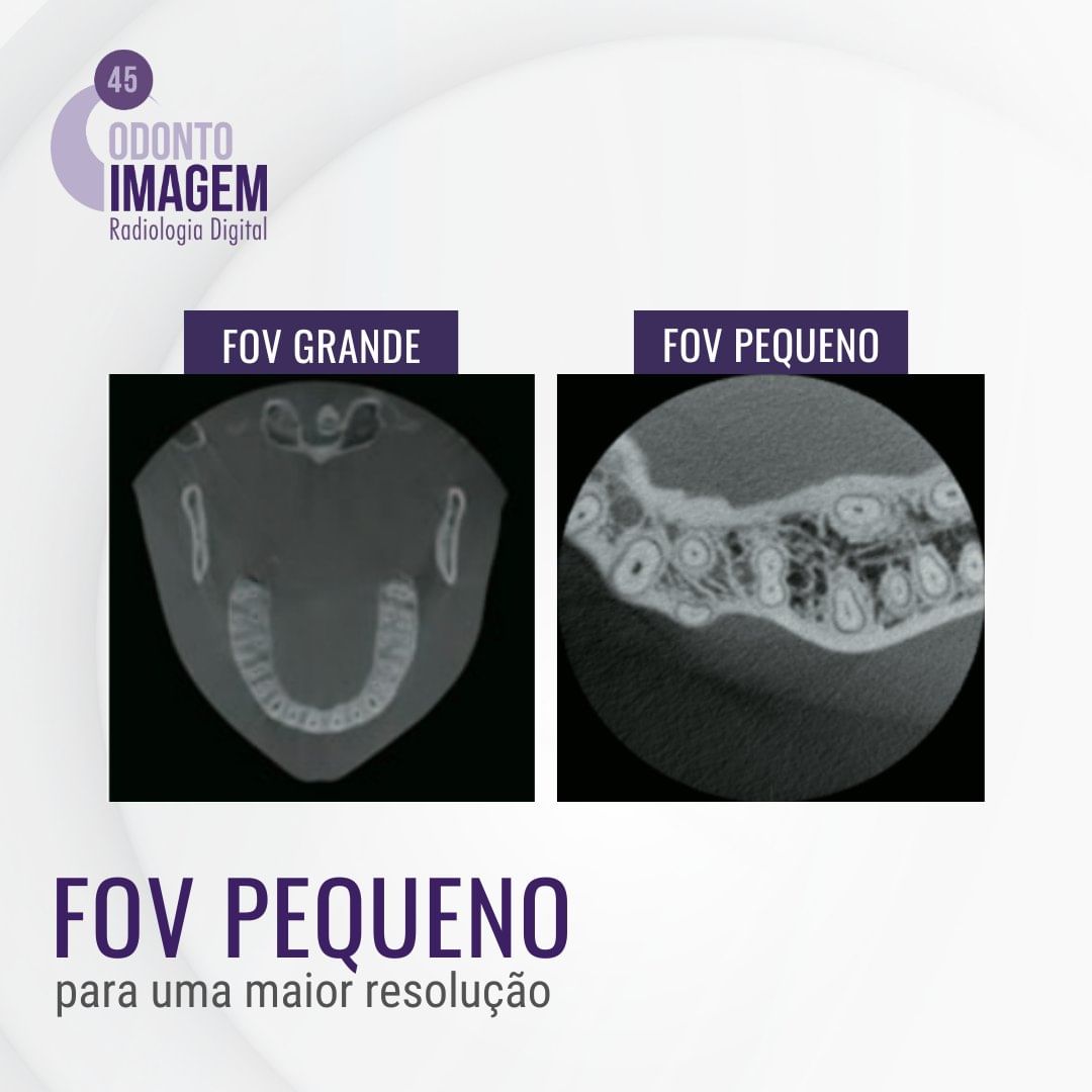 fov-pequeno