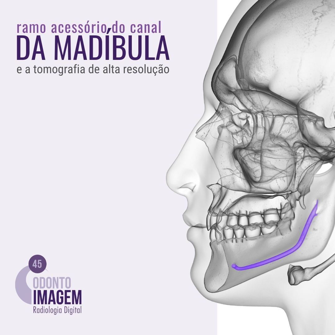 ramo-acessorio-do-canal-da-mandibula