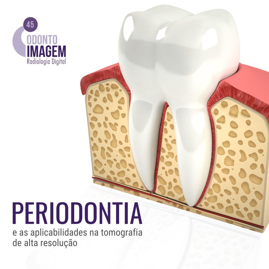 periodontia