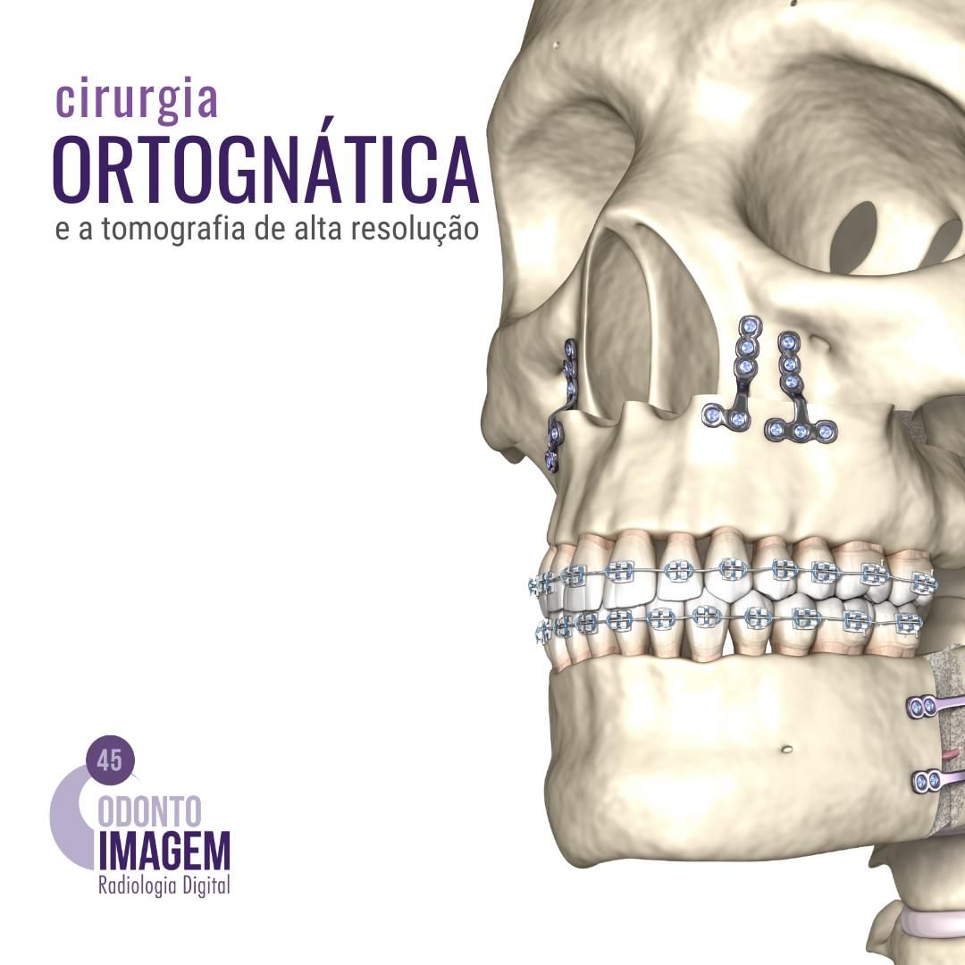 cirurgia-ortognatica