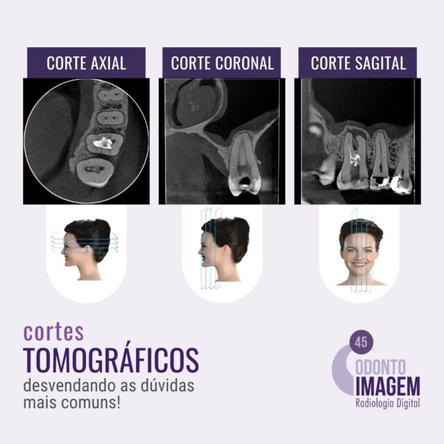 CORTES TOMOGRÁFICOS – Odonto Imagem