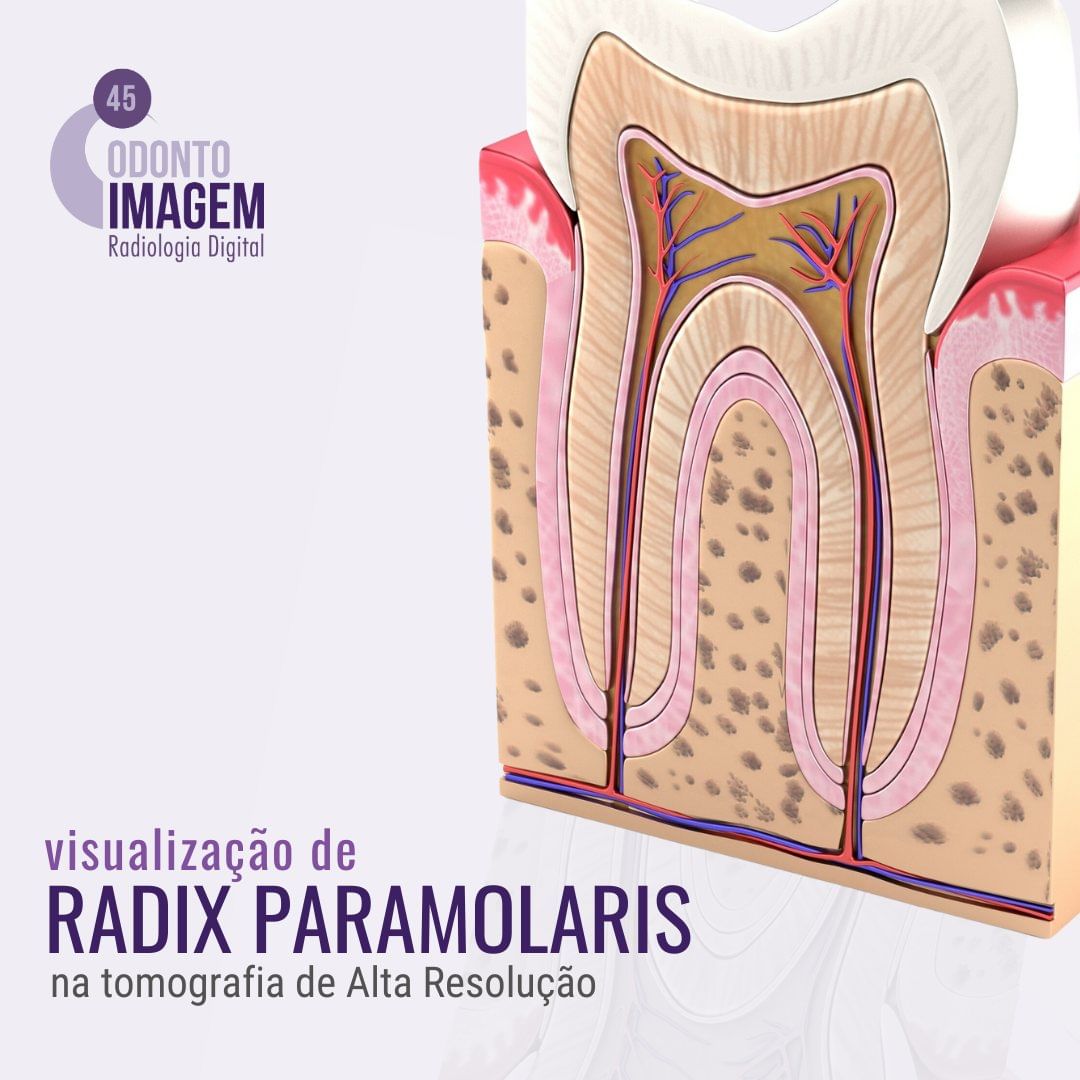 visualizacao-de-radix-paramolaris