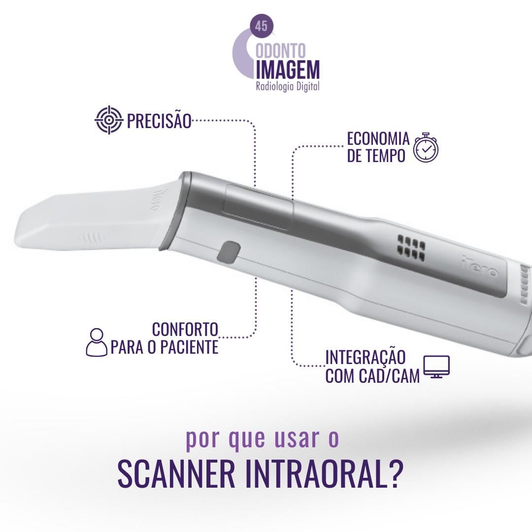 por-que-usar-o-scanner-intraoral