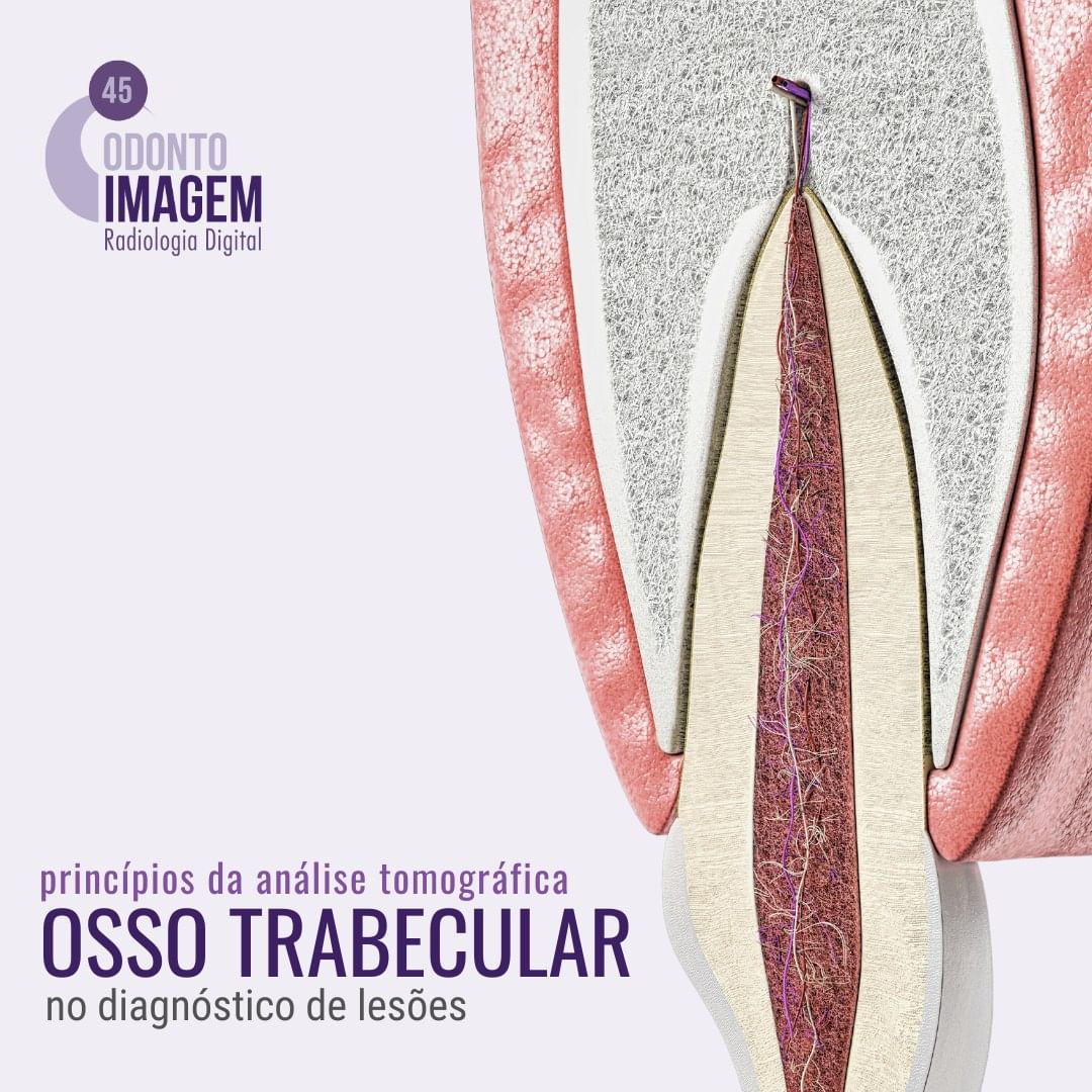 principios-da-analise-tomografica-osso-trabecular