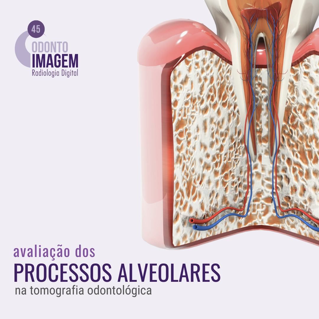 avaliacao-dos-processos-alveolares