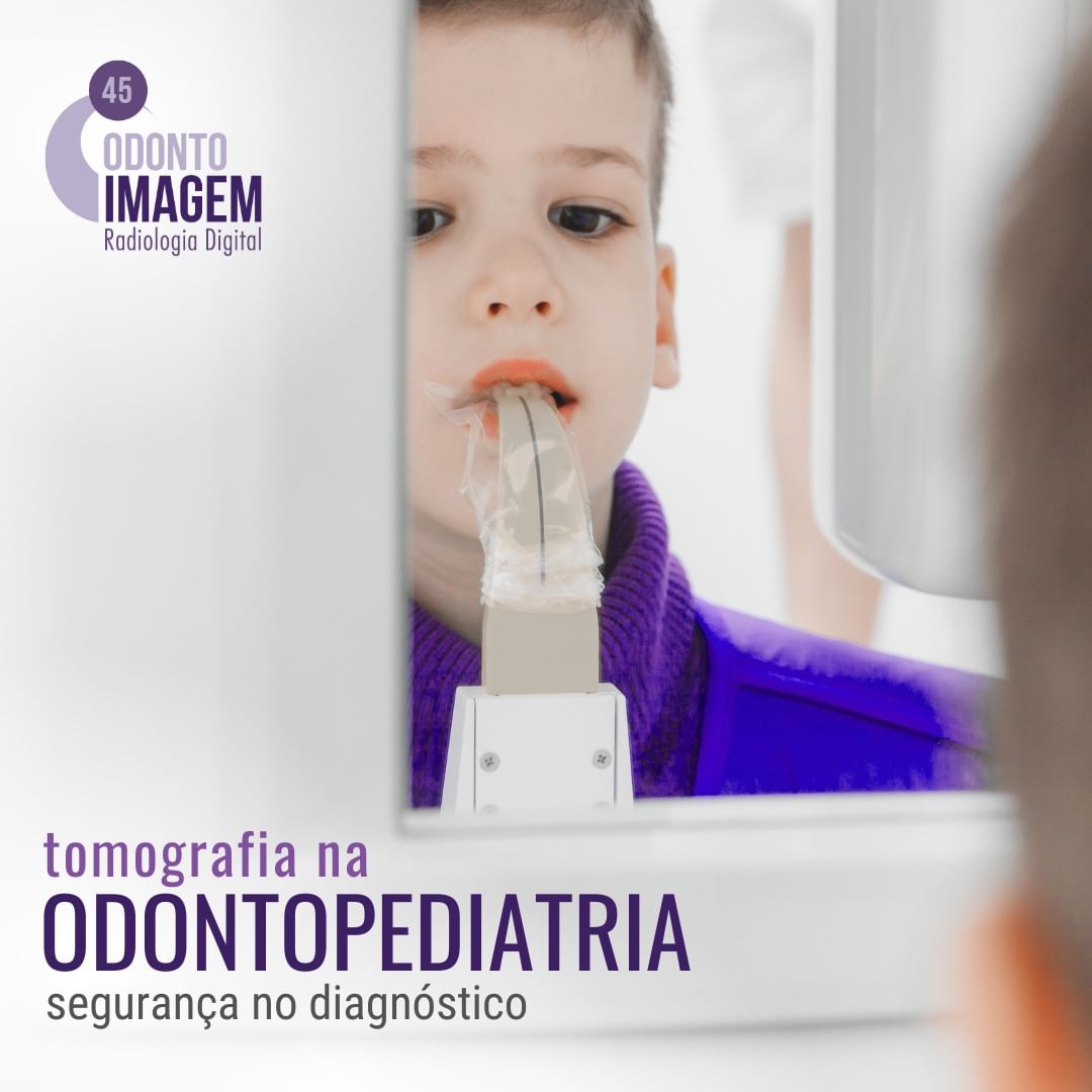 tomografia-na-odontopediatria