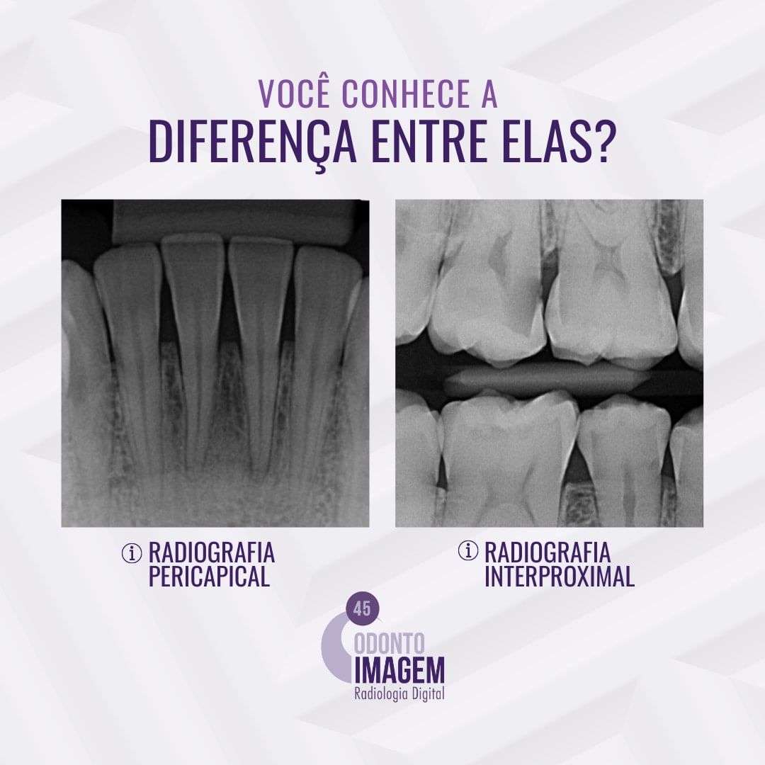 voce-conhece-a-diferenca-entre-elas