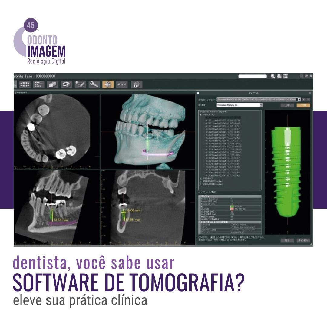 dentista-voce-sabe-usar-software-de-tomografia