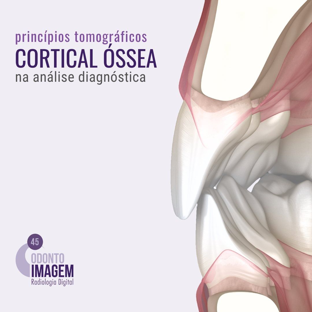 principios-tomograficos-cortical-ossea