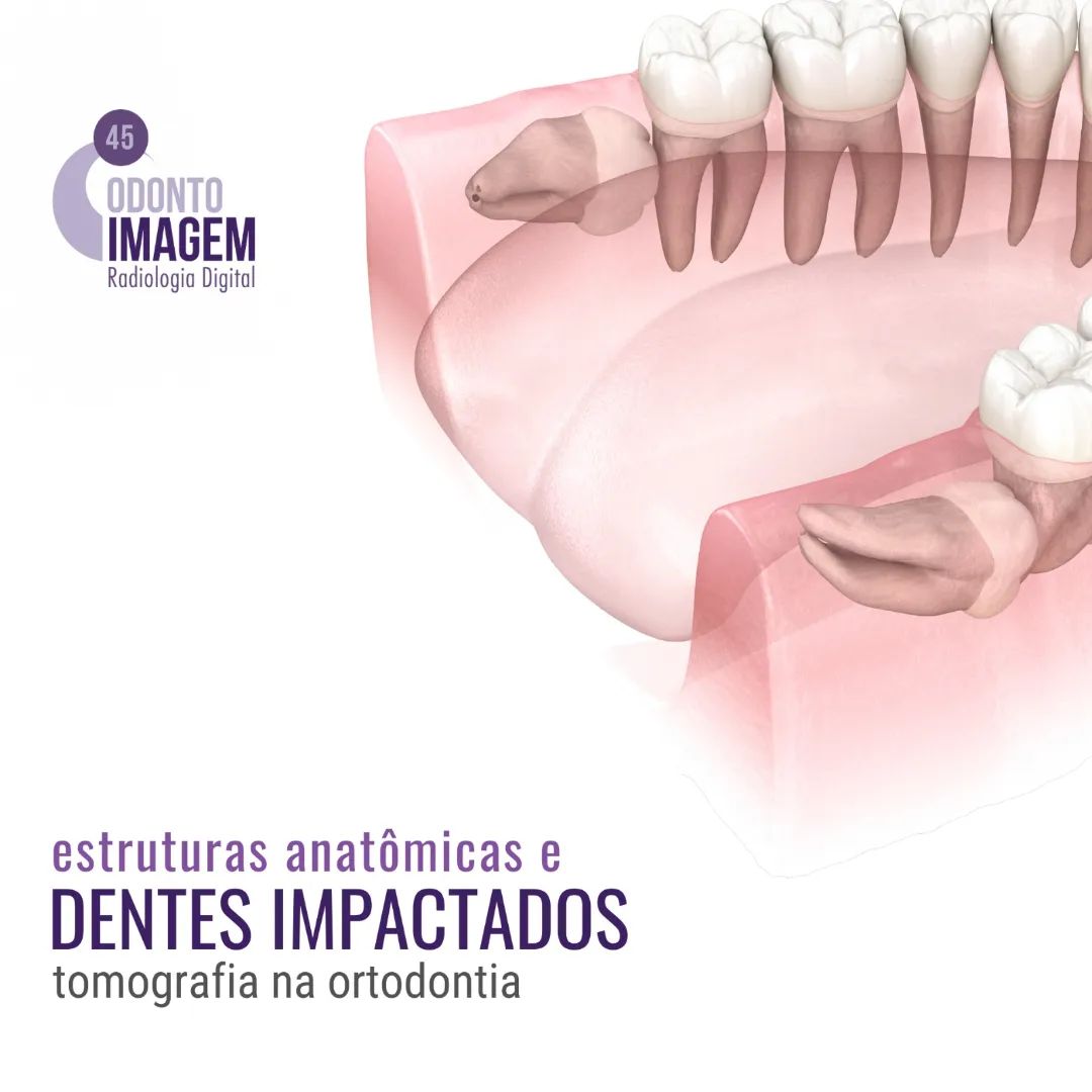 estruturas-anatomicas-e-dentes-impactados