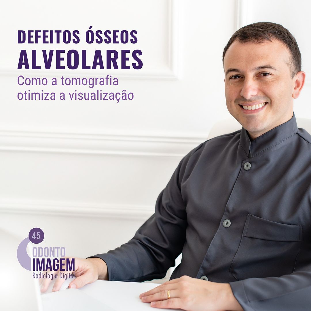 defeitos-osseos-alveolares