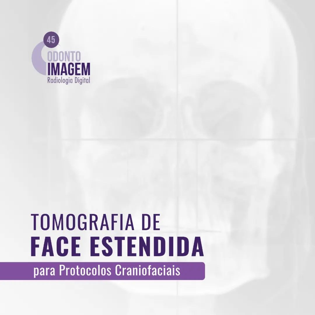 tomografia-de-face-estendida