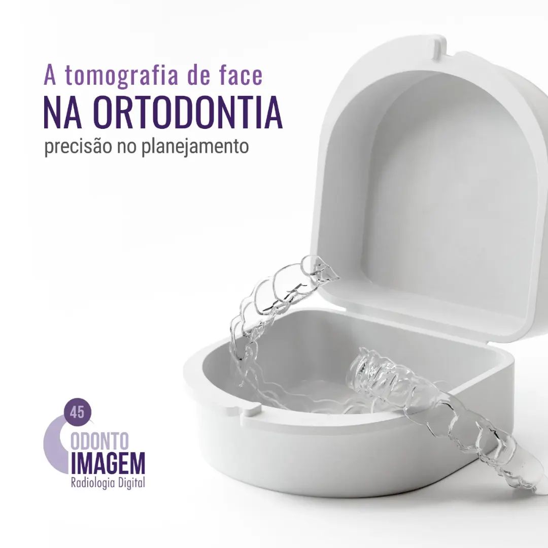 a-tomografia-de-face-na-ortodontia