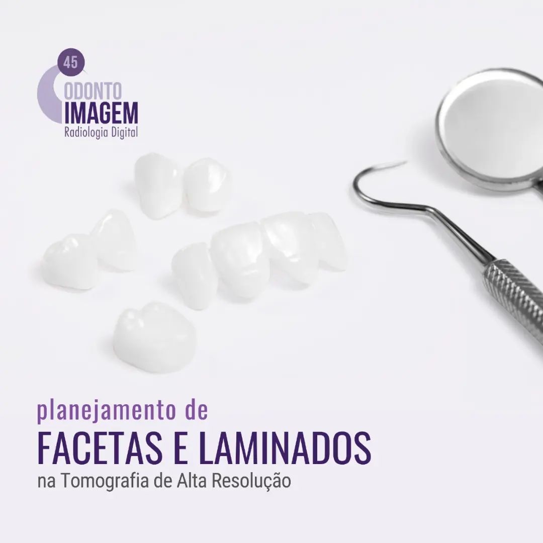 planejamentos-de-facetas-e-laminados