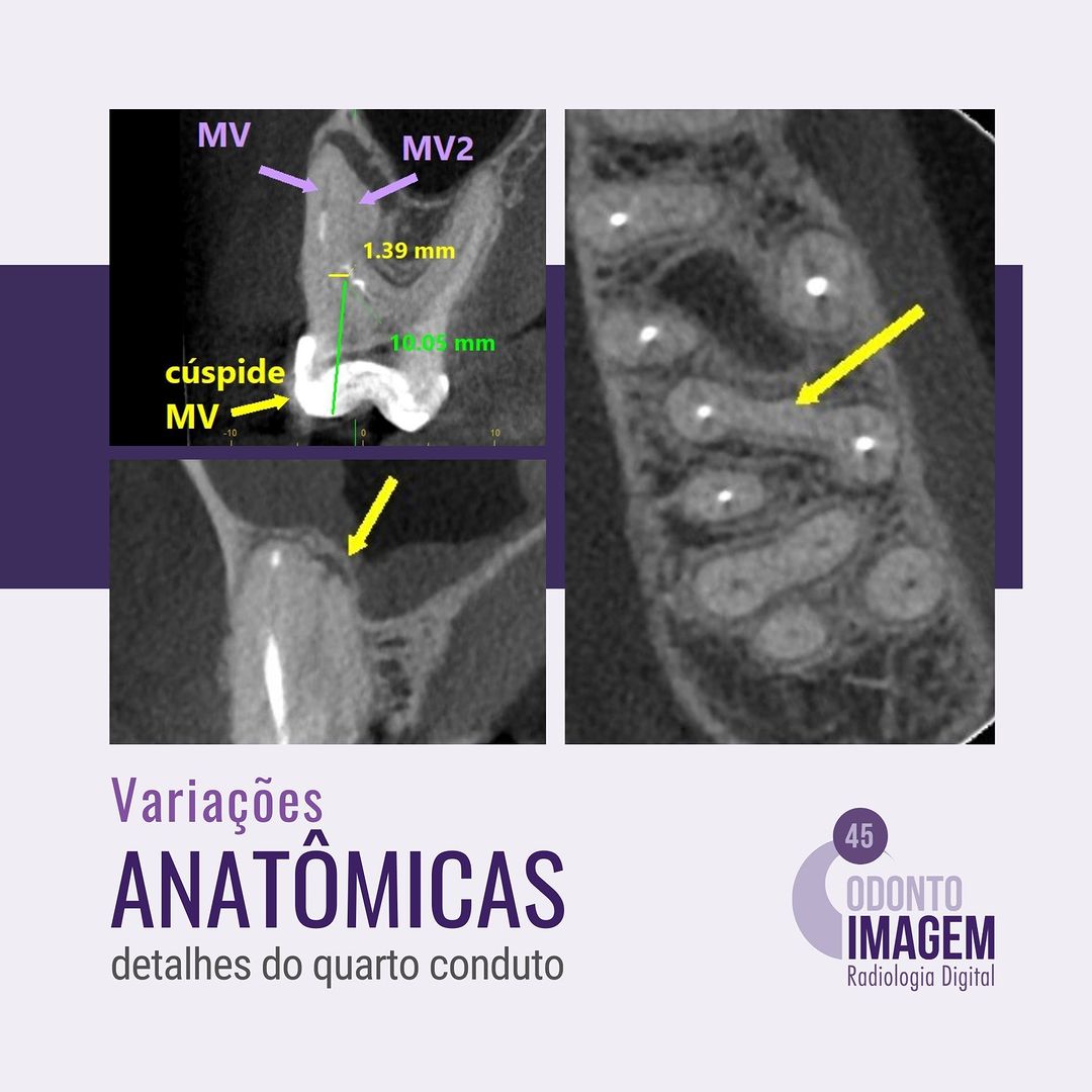 variacoes-anatomicas