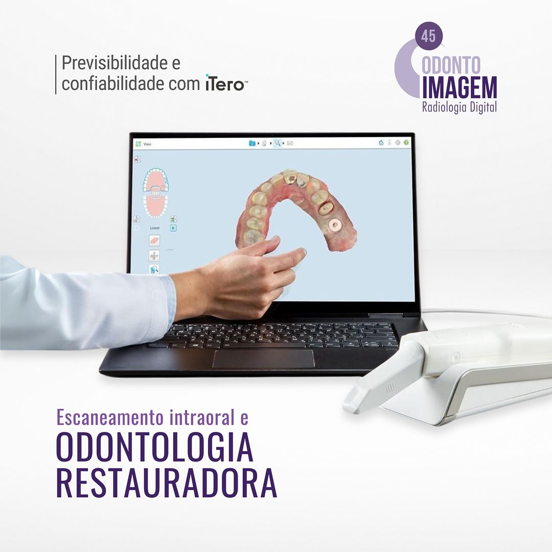 escaneamento-intraoral-e-odontologia-restauradora