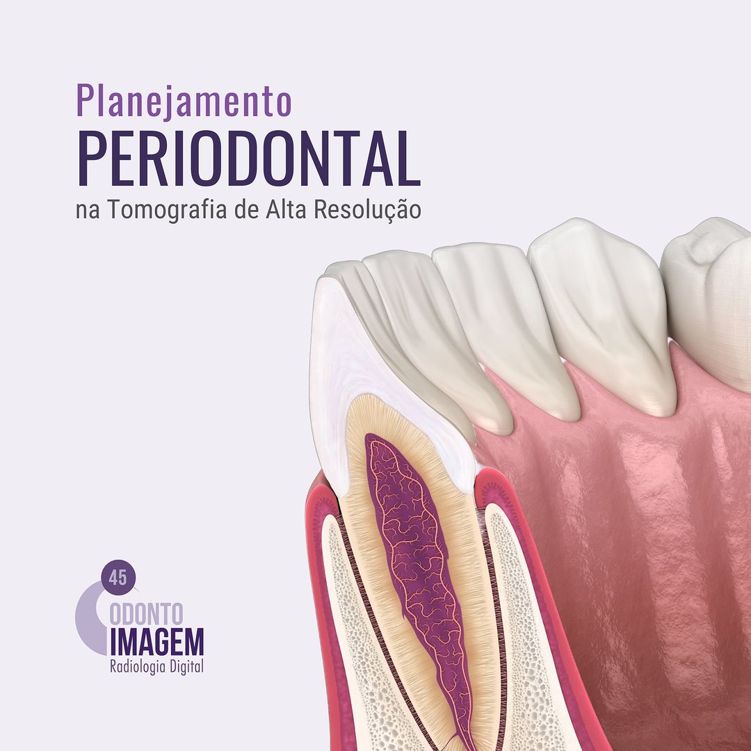 planejamento-periodontal