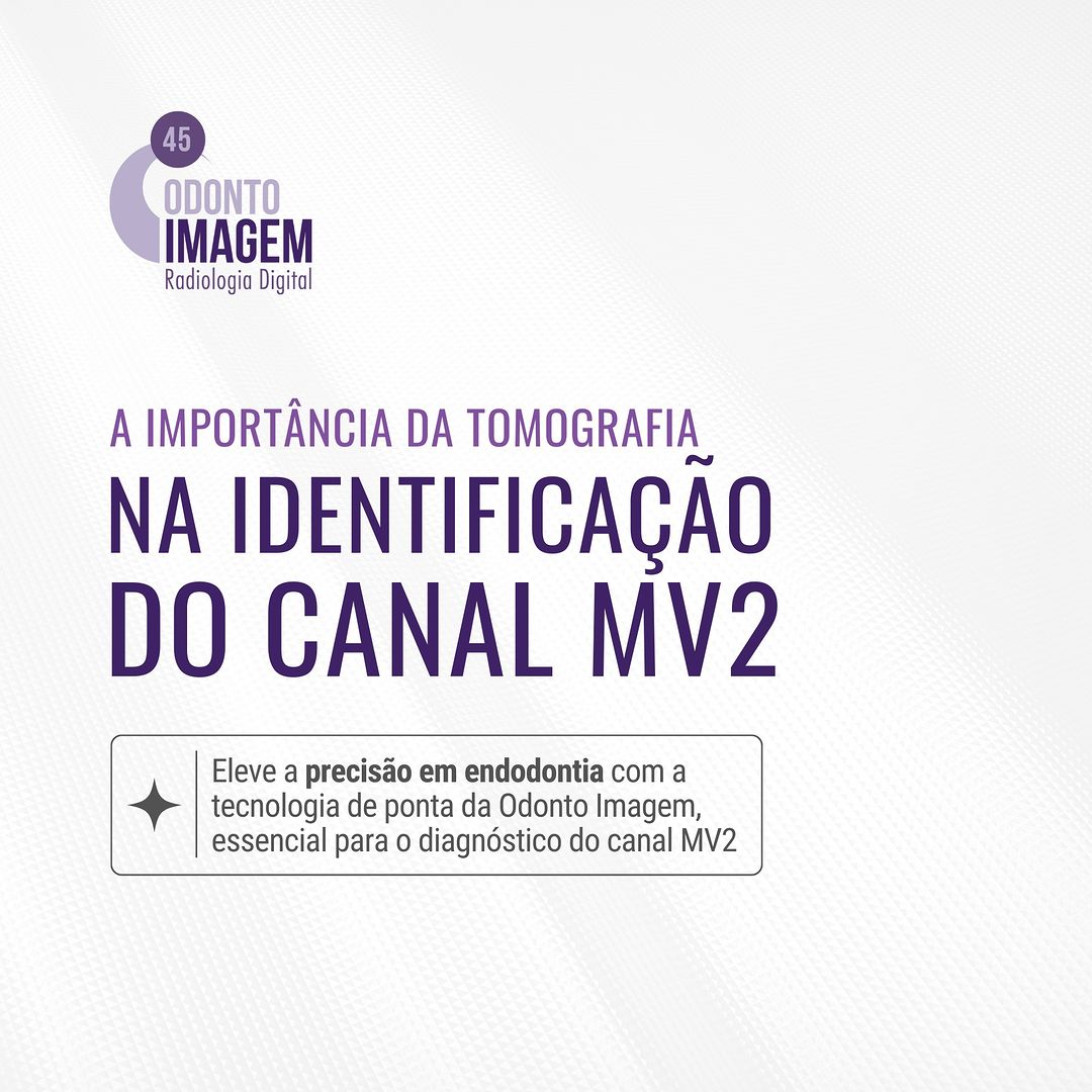 a-importancia-da-tomografia-na-identificacao-do-canal-mv2