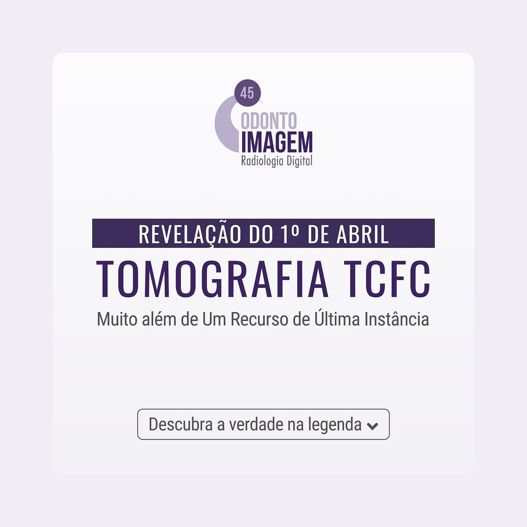 tomografia-tcfc