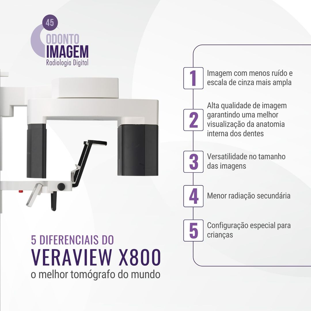 5-diferenciais-do-veraview-x800