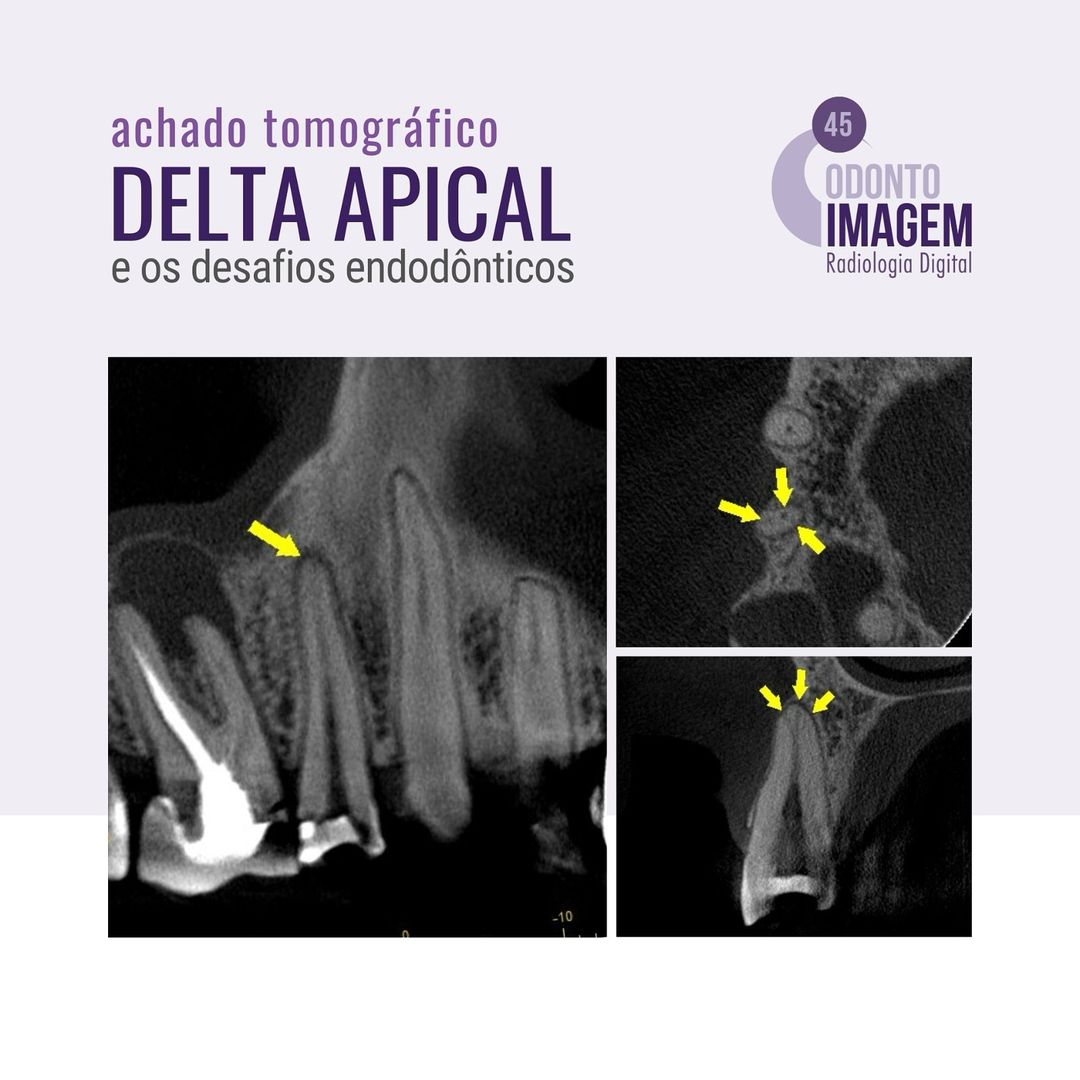 delta-apical