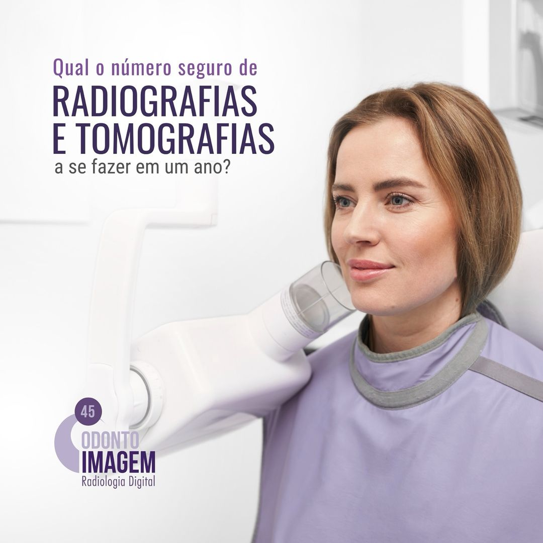 qual-o-numero-seguro-de-radiografias-e-tomografias-a-se-fazer-em-um-ano-?