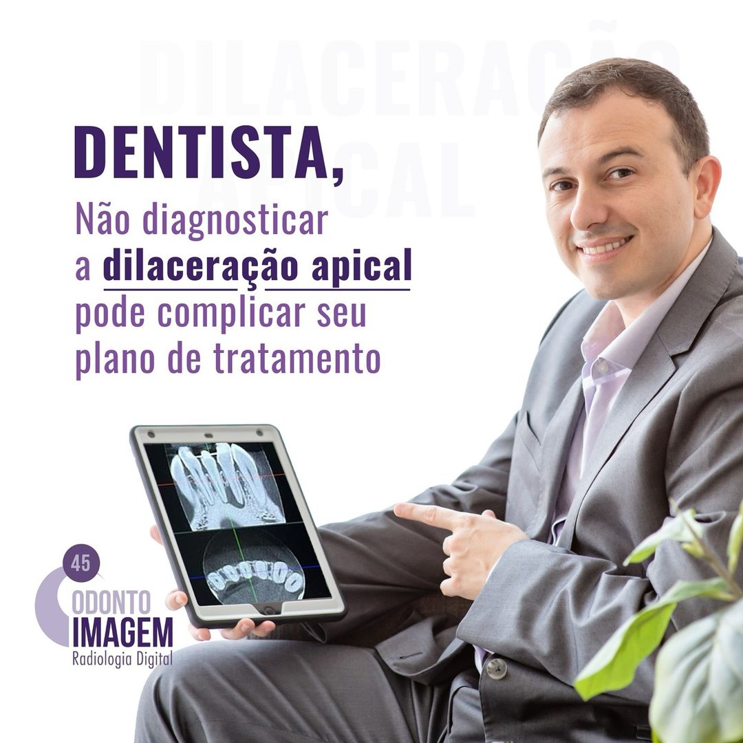 dentista-nao-diagnosticar-a-dilaceracao-apical-pode-complicar-seu-plano-de-tratamento