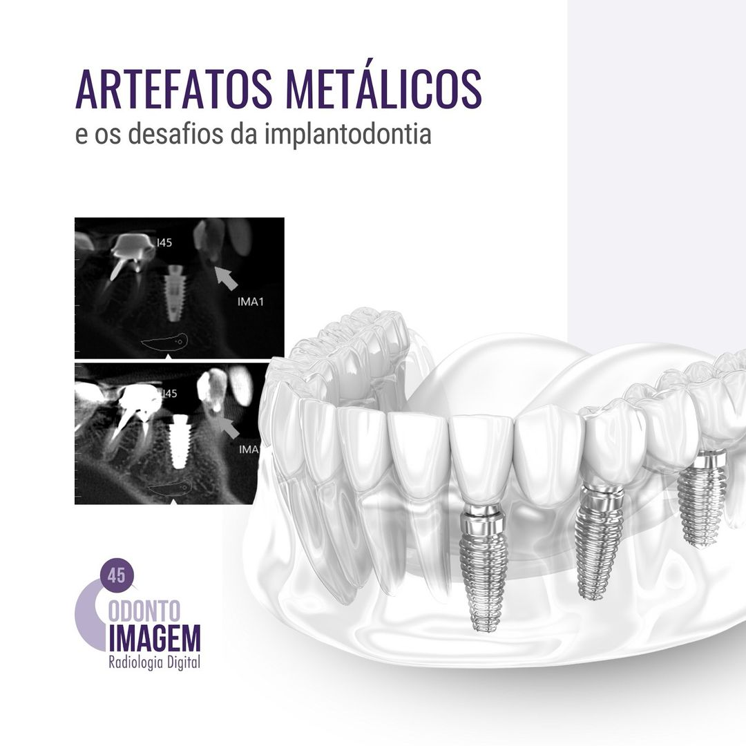 artefatos-metalicos