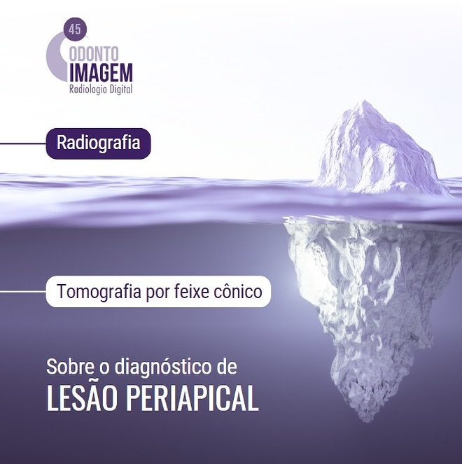 diagnostico-de-lesao-periapical