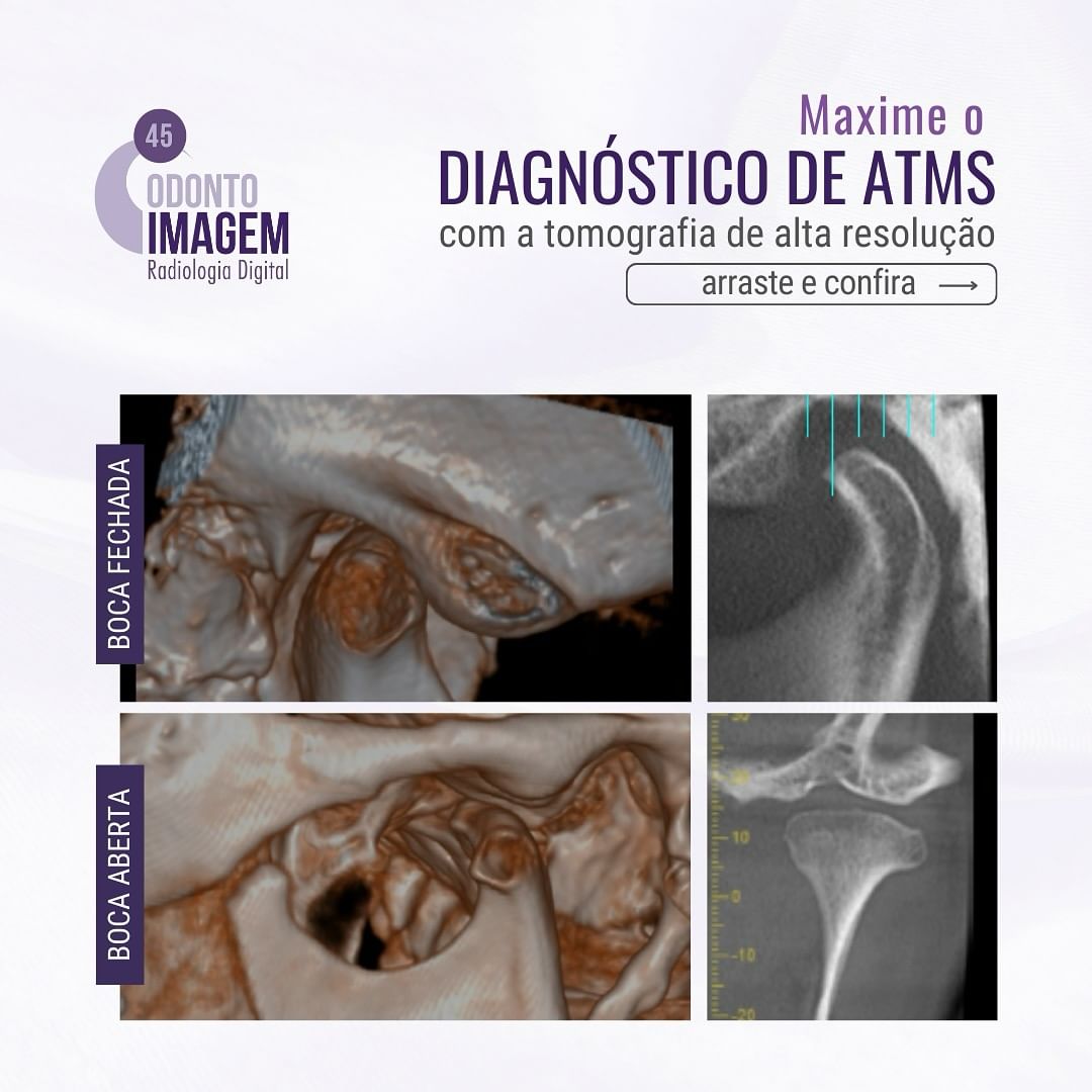 maximize-o-diagnostico-de-atms