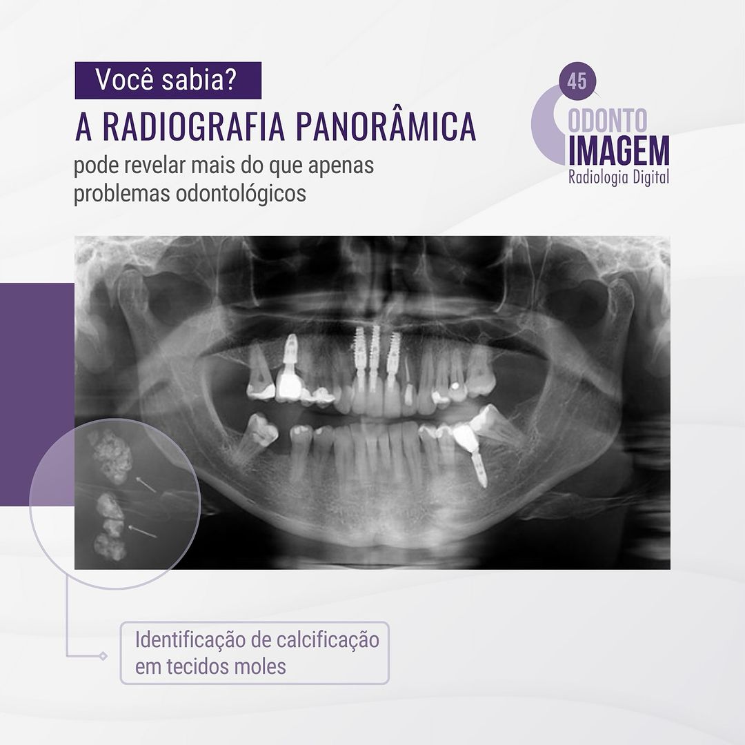 a-radiografia-panoramica