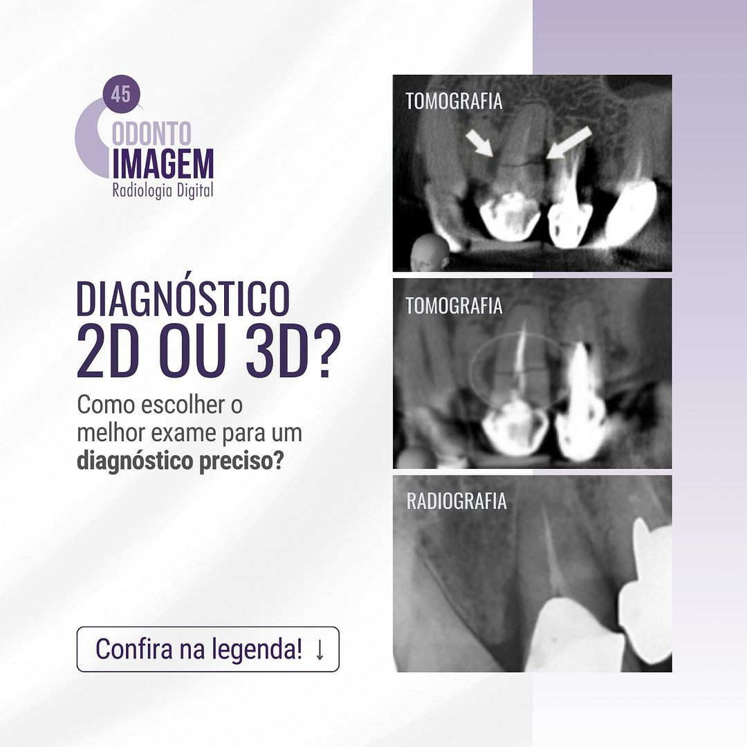 diagnostico-2d-ou-3d