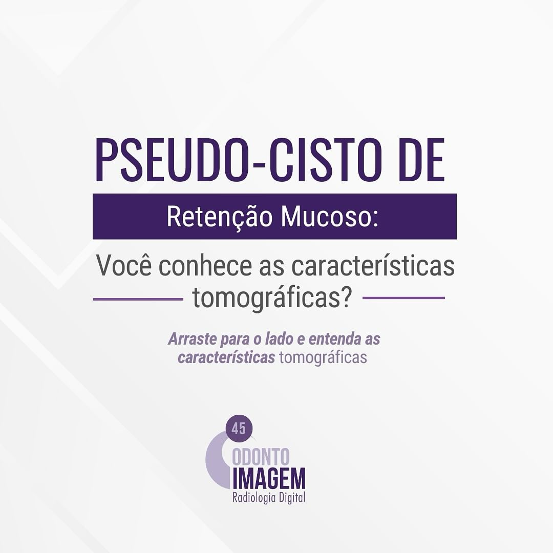 pseudo-cisto-de-retencao-mucoso