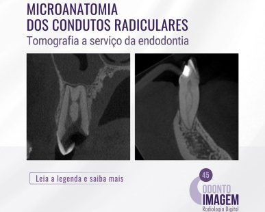 microanatomia-dos-condutos-radiculares