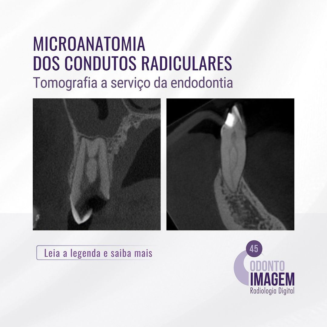 microanatomia-dos-condutos-radiculares