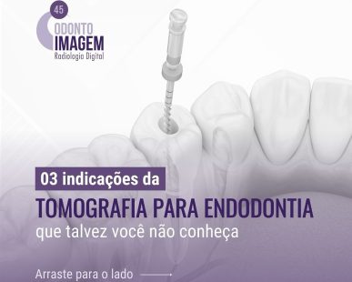 tomografia-para-endodontia