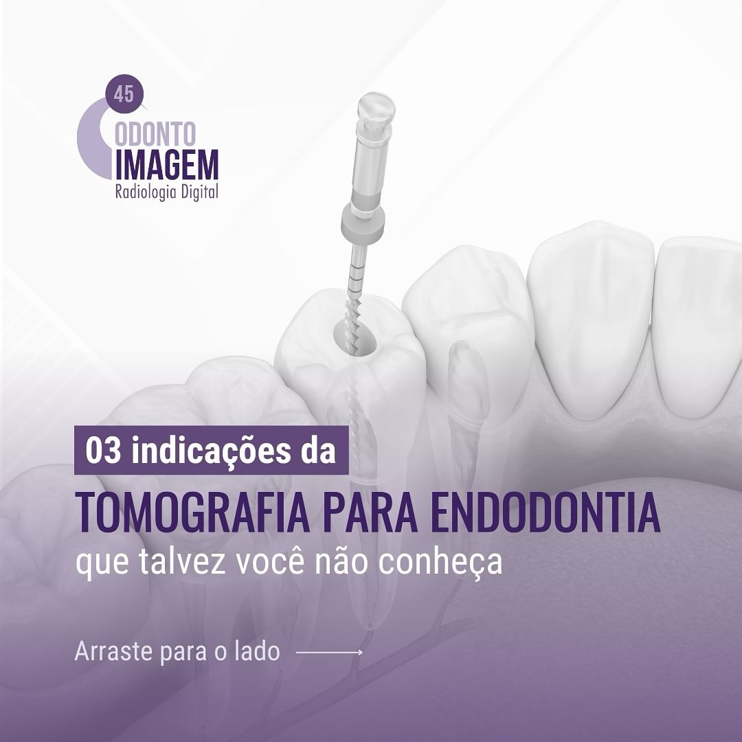 tomografia-para-endodontia