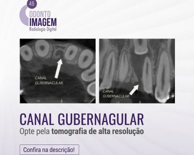 o-canal-gubernacular