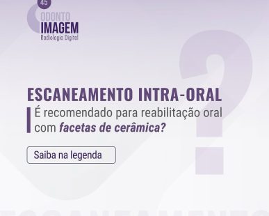 escaneamento-intraoral